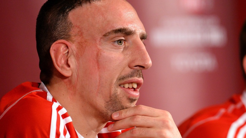 Cầu thủ Franck Ribery - Hành trình đến với đỉnh cao của gã mặt sẹo 1 Cầu thủ Franck Ribery - Hành trình đến với đỉnh cao của gã mặt sẹo